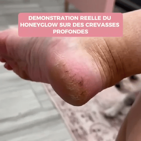 Verlix Glow™ – La Ponceuse Pieds pour des Talons Doux & Lisses