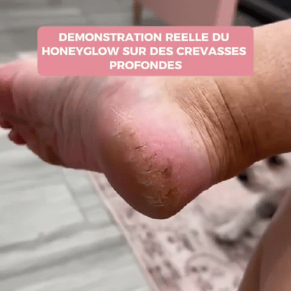 Verlix Glow™ – La Ponceuse Pieds pour des Talons Doux & Lisses