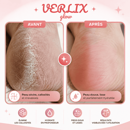 Verlix HoneyBalm™ – Baume Réparateur pour Pieds Secs & Talons Abîmés