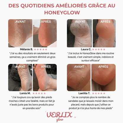 Verlix Glow™ – La Ponceuse Pieds pour des Talons Doux & Lisses