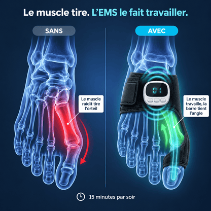 Verlix™ - Attelle EMS Hallux Valgus
